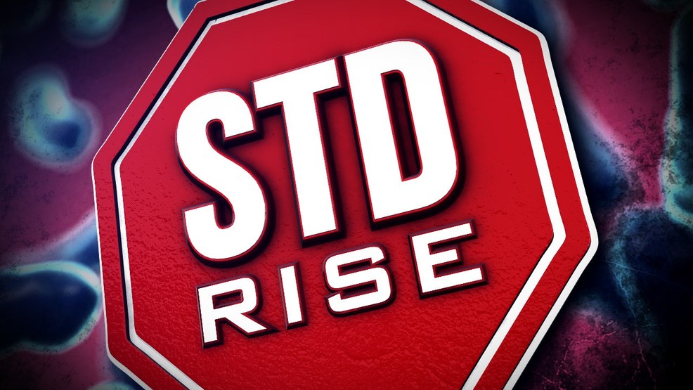Health officials report dramatic increase in sexually-transmitted diseases in Shasta Co. - KRCRTV.COM thumbnail