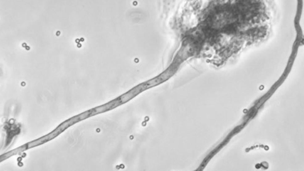 SU student diagnosed with case of bacterial meningitis WSTM