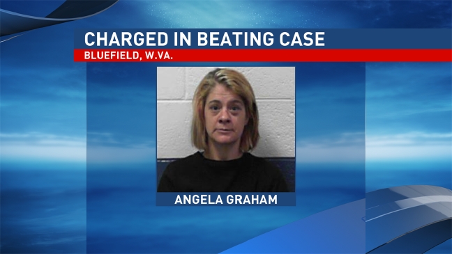 Police: Elderly woman beaten by son's girlfriend with bat, sledgehammer, rolling pin